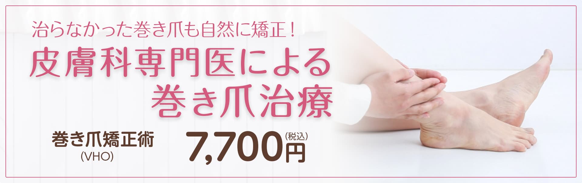 皮膚科専門医による巻き爪治療　7,000円（税別）〜